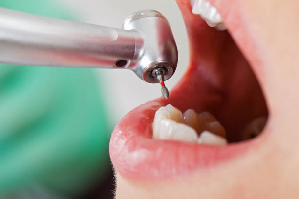 Best Emergency Wisdom Teeth Removal in View Park Windsor Hills, CA